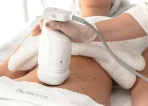 liposonic en jerez y el puerto de santa maría